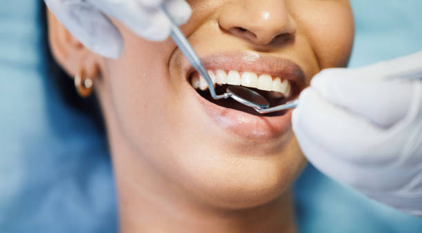 Best Same-Day Emergency Dental Services in Mount Pleasant, MI